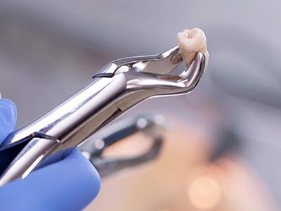 JEV DMD and Associates | Same Day Crowns, Veneers and Extractions
