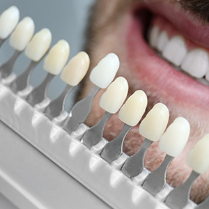 JEV DMD and Associates | Ceramic Crowns, Implant Dentistry and Preventative Program