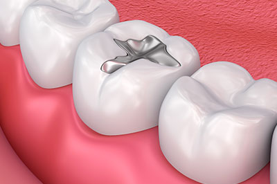JEV DMD and Associates | Implant Dentistry, Cosmetic Dentistry and Dental Cleanings