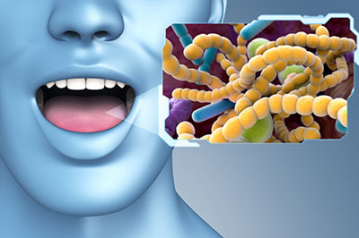 JEV DMD and Associates | Dental Bonding, Implant Dentistry and Implant Restorations