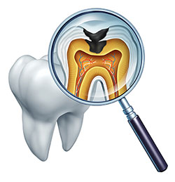 JEV DMD and Associates | Wisdom Teeth Extractions, Ceramic Crowns and Dentures