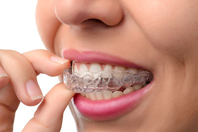 JEV DMD and Associates | Full Mouth Reconstruction, Extractions and Root Canals