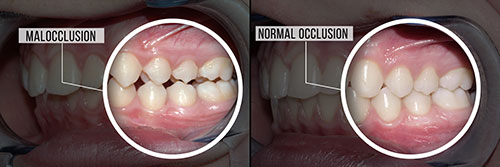 JEV DMD and Associates | Cosmetic Dentistry, Extractions and Dentures