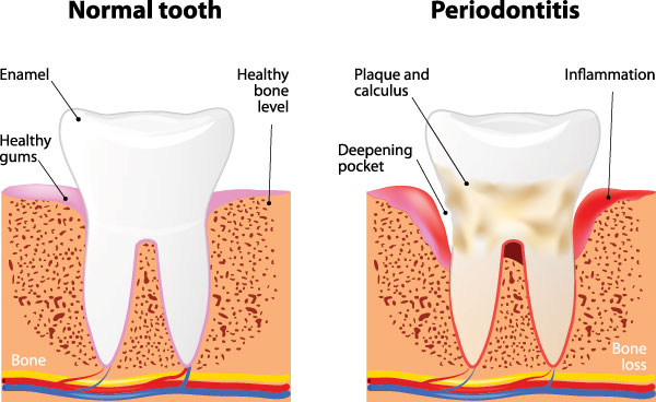 JEV DMD and Associates | Full Mouth Reconstruction, Dental Bridges and Wisdom Teeth Extractions
