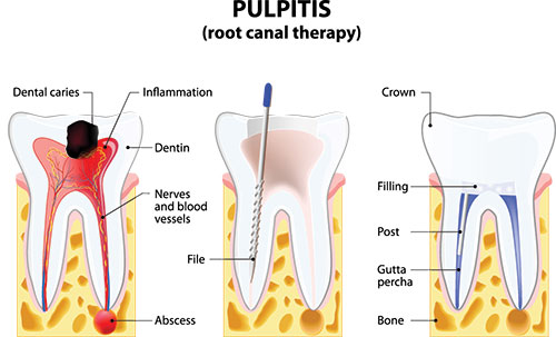 JEV DMD and Associates | Oral Exams, Root Canals and Teeth Whitening