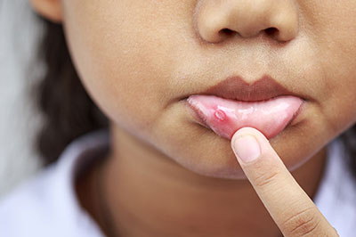 JEV DMD and Associates | Oral Exams, Full Mouth Reconstruction and Dental Fillings