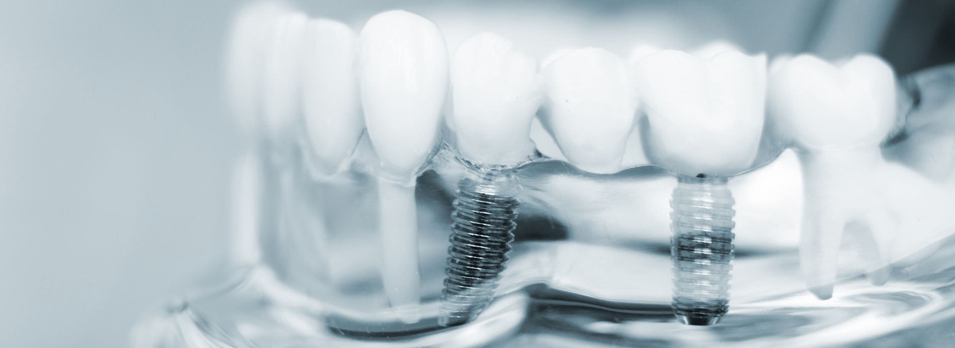 JEV DMD and Associates | Oral Exams, Dental Bridges and Full Mouth Reconstruction