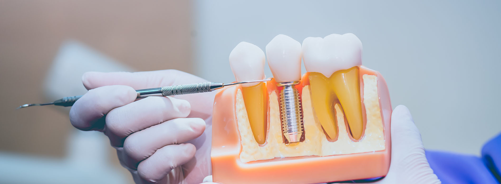 JEV DMD and Associates | Same Day Crowns, Full Mouth Reconstruction and Preventative Program