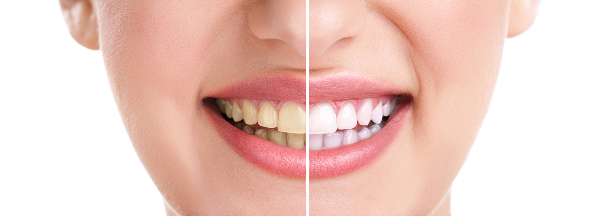JEV DMD and Associates | Implant Dentistry, Preventative Program and Cosmetic Dentistry