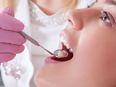 JEV DMD and Associates | Wisdom Teeth Extractions, Dental Cleanings and Preventative Program